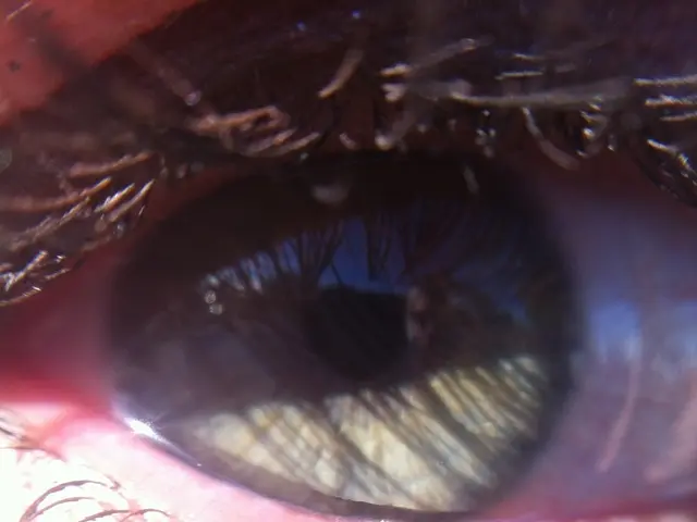 Treatment Options for Diabetic Retinopathy: Key Facts to Consider